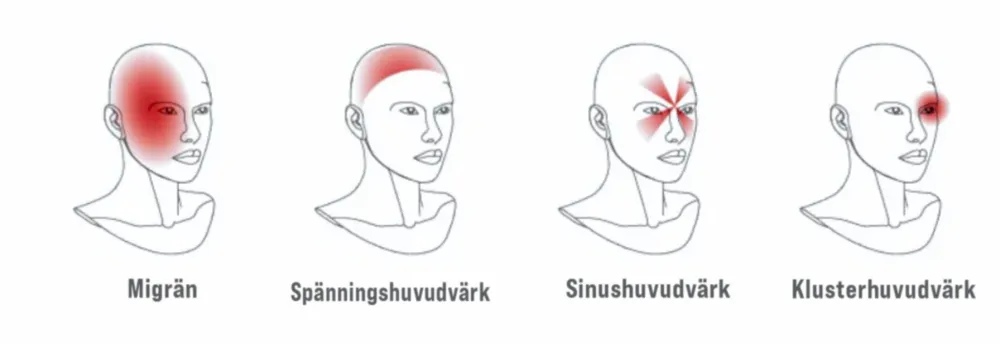 Headache Types Killing Your Neck C Sm Sv