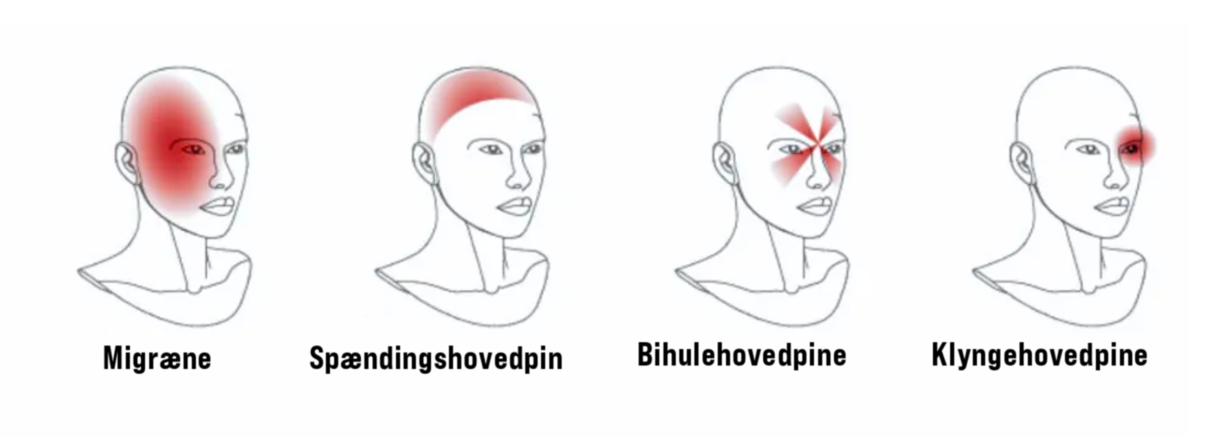 Headache types killing your neck C SM DA