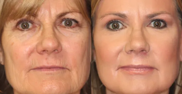 Screenshot 2025 03 13 at 16.24.39